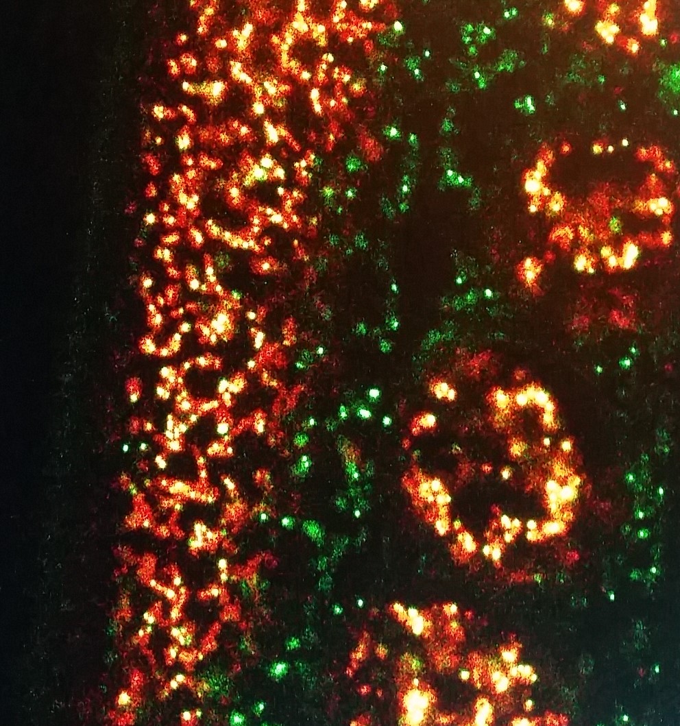 C. elegans germline with mitochondria shown in red, mitochondrial DNA shown in green.